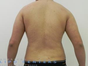 americanlipocenters_118.jpg